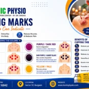 Cupping Therapy in Sector 57 Gurgaon | Ikonic Physio