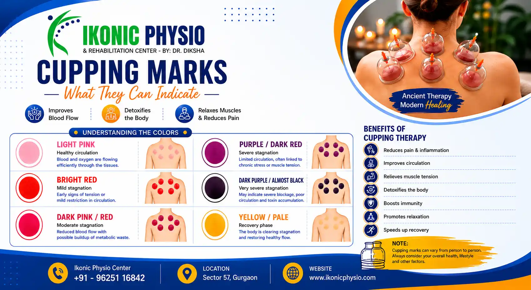 Cupping Therapy in Sector 57 Gurgaon | Ikonic Physio